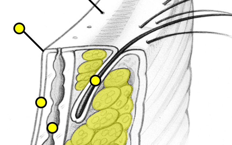 Eyelid Margin Anatomy